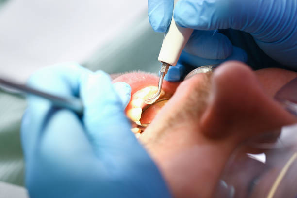 Best Emergency TMJ Treatment in Sunset, FL